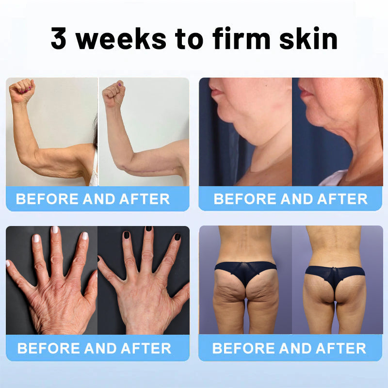šODALIT⢠Botox Bee Venom Firming Serum Stick(š„LAST DAY 70% OFF)š§”