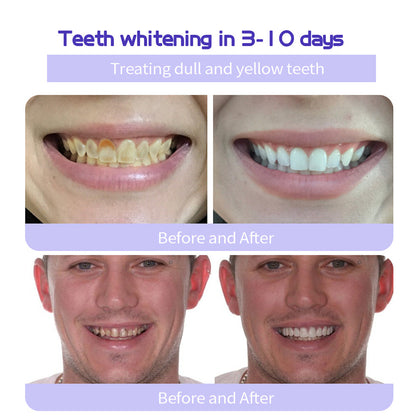 🎁Flash Sale - Don’t Miss Out - ODALIT™ TeethRestoration Mineral Powder🦷(CDA recommended)👩‍⚕️(Treats periodontitis and mouth ulcers, prevents tooth loss, and repairs gum recession)