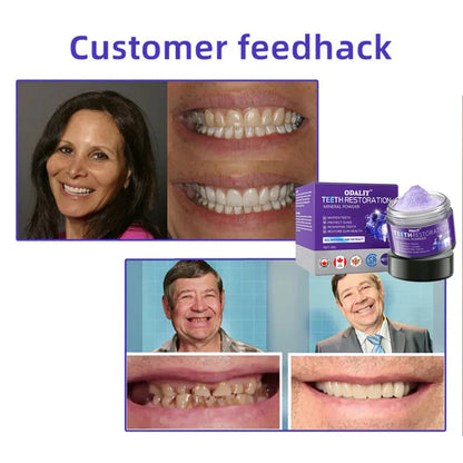 🎁Flash Sale - Don’t Miss Out - ODALIT™ TeethRestoration Mineral Powder🦷(CDA recommended)👩‍⚕️(Treats periodontitis and mouth ulcers, prevents tooth loss, and repairs gum recession)